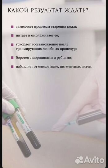 Плазмотерапия, плазмолифтинг, PRP