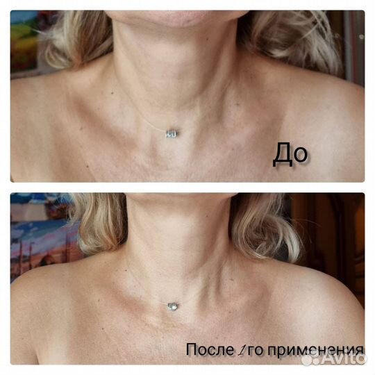 Сыворотка лифтинг anny ray