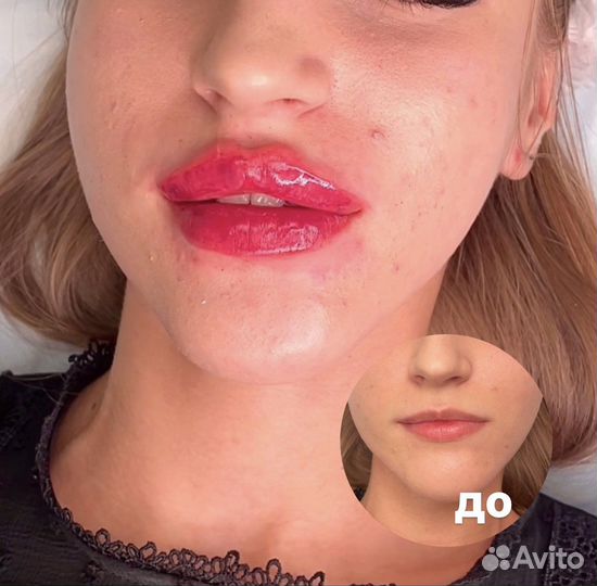 Врач косметолог