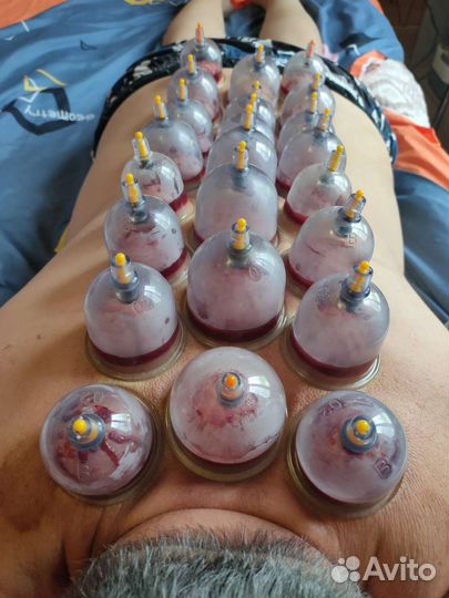 Восстановление после инсульта