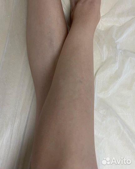 Шугаринг (депиляция сахарной пастой), гелинг