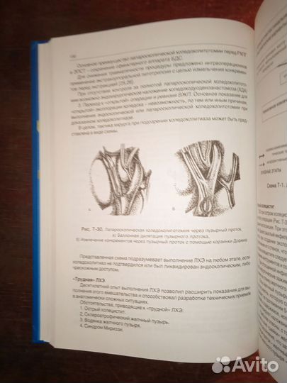 Оперативная лапароскопия в хирургии, гинекологии