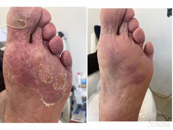 Услуги подолога