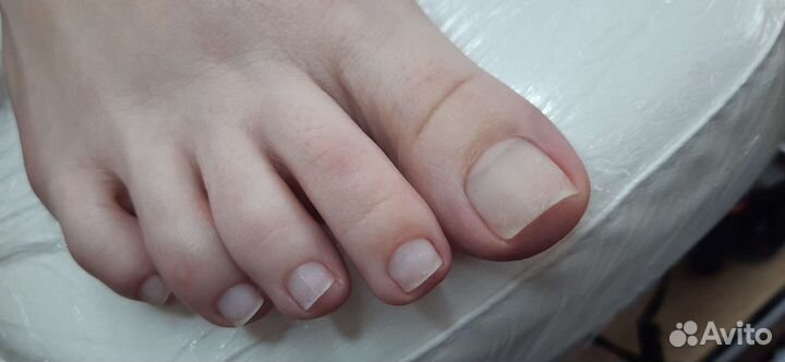 Педикюр препаратами Golden Trace