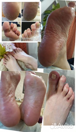 Педикюр на дому