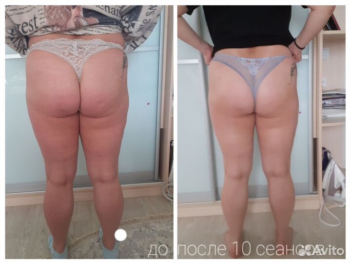 Массаж лица, безоперационное омоложение