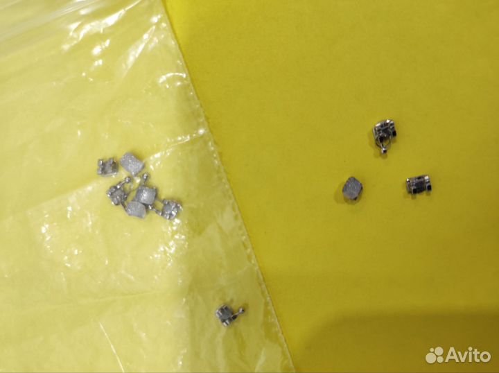 Остатки после ортодонического лечения