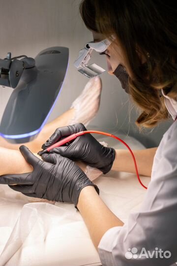 Электроэпиляция