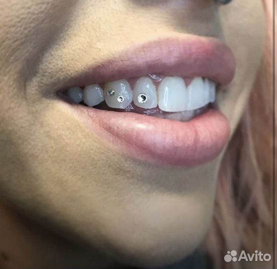 Установка Скайс