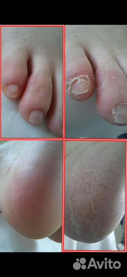 Маникюр, наращивание, педикюр Дар-Гора