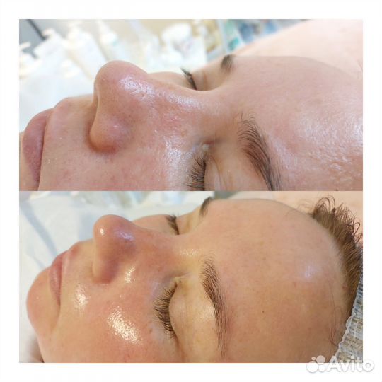 Косметолог, трихолог. Массаж лица