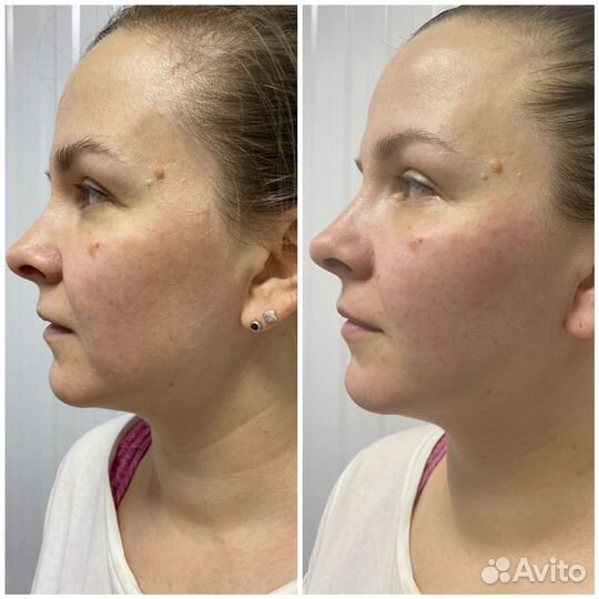 Массаж на дому