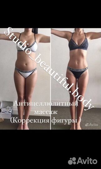 Антицеллюлитный массаж,LPG массаж