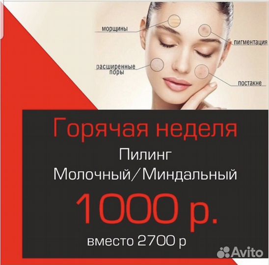 Узи чистка и пилинги