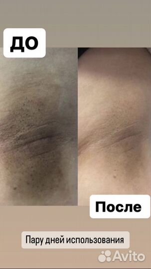 Для отбеливания интимных зон