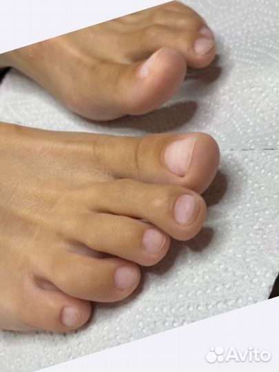 Педикюр любой сложности