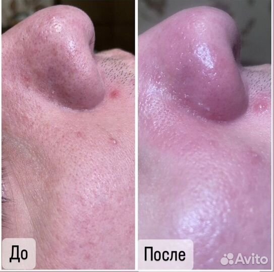 Врач-косметолог услуги