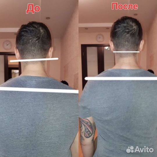 Аппаратный массаж шейно-воротниковой зоны