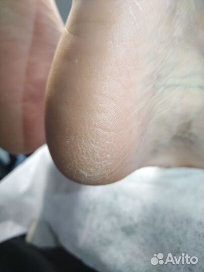 Смарт педикюр