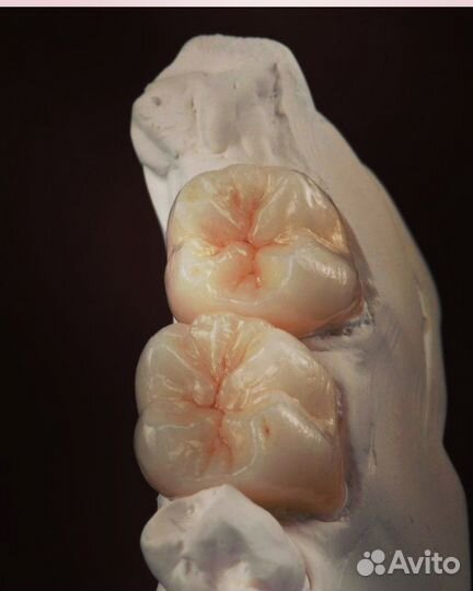 Зубной техник керамист