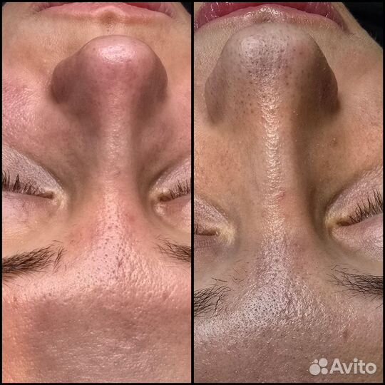 Косметолог эстетист