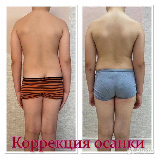 Массаж. Коррекция фигуры, осанки