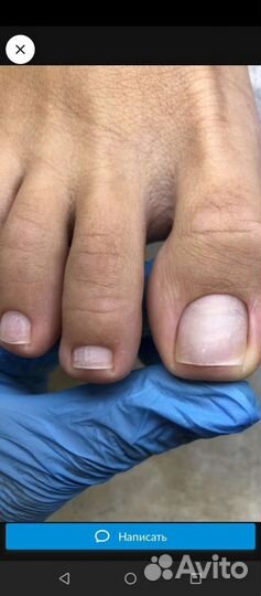 Аппаратный педикюр