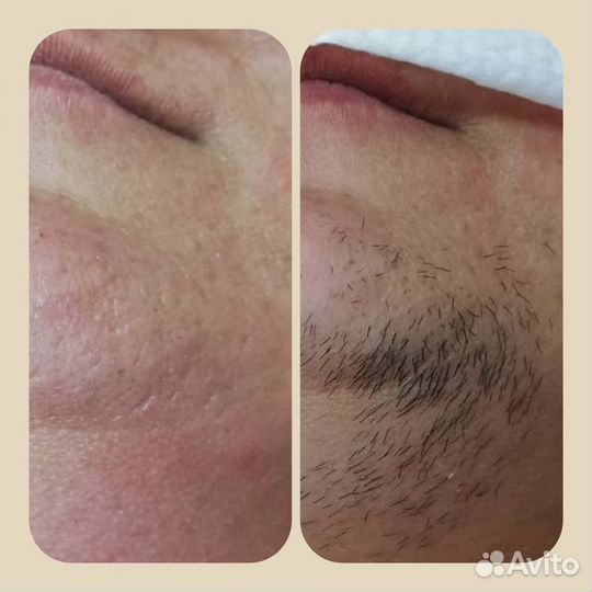 Депиляция Косметолог Массаж лица 7 видов