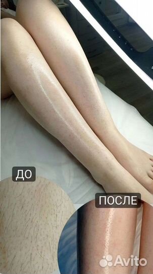 Шугаринг/Златоуст