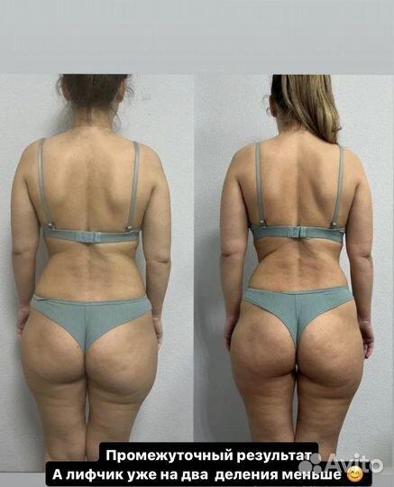 LPG, вакуумный, вибромассаж, антицеллюлитный