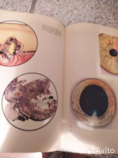 Офтальмология