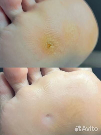 Услуги подолога