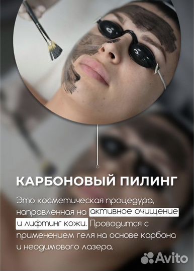 Карбоновый пилинг