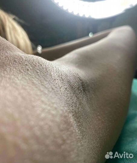 Шугаринг/ депиляция воском