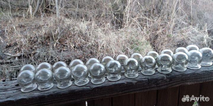 Банки медицинские на спину СССР