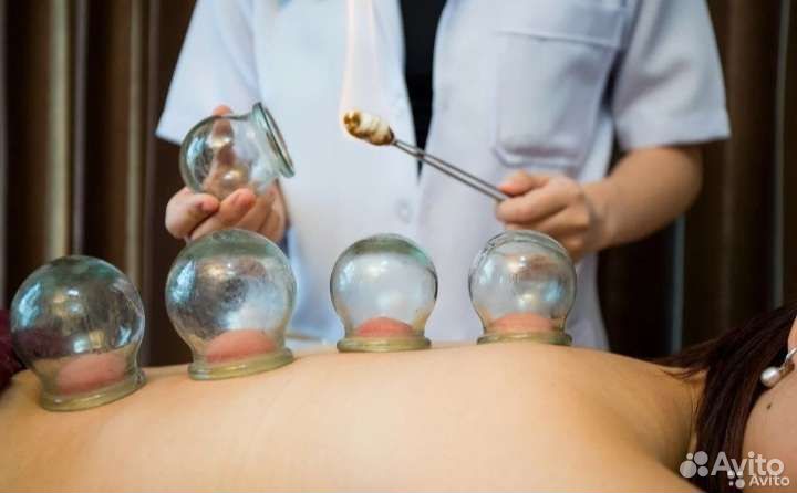 Банки стеклянные медицинские. СССР