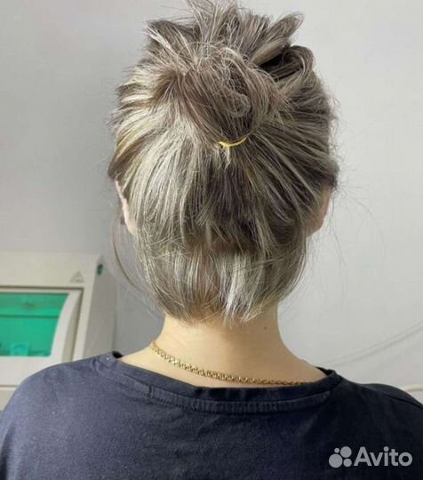 Отопластика нитевая