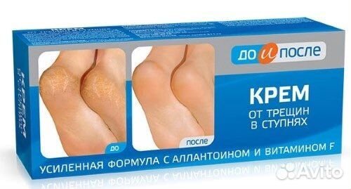 Крем для ног от трещин