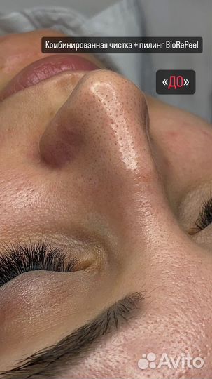 Косметолог эстетист услуги