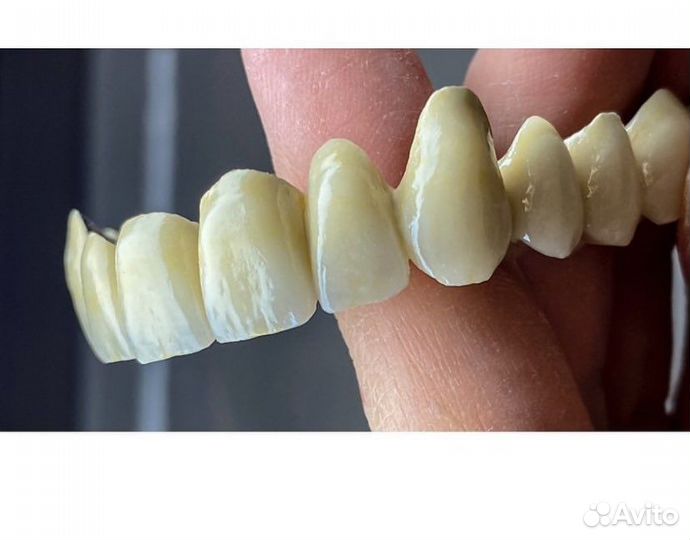 Зубной техник керамист