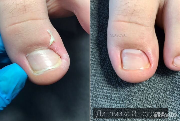 Подология маникюр педикюр