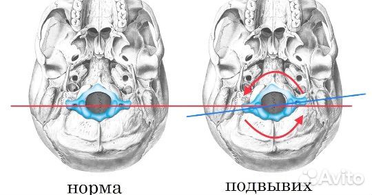 Правка Атланта atlasprofessional