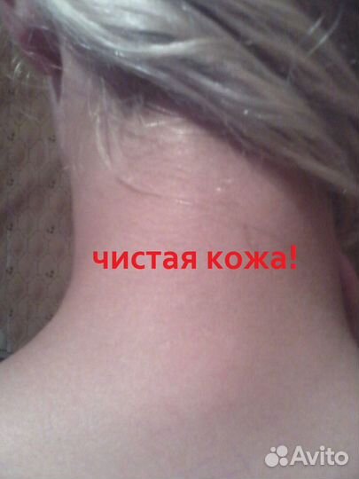 Удаление тату