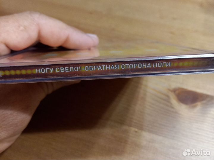 Ногу свело. Обратная сторона ноги