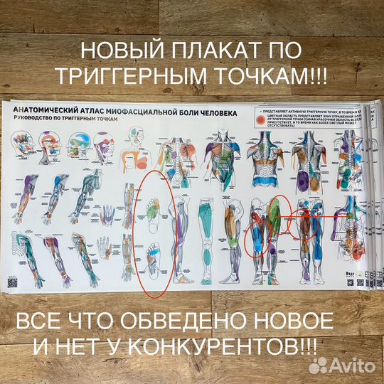 Триггерные точки плакаты