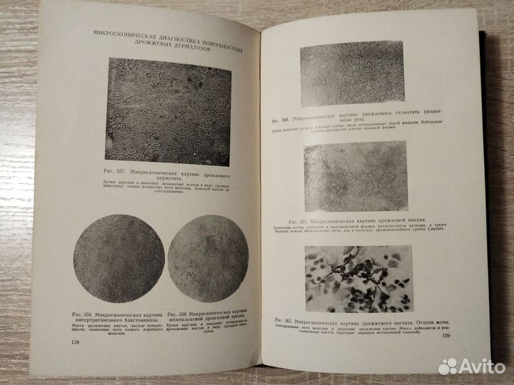 Атлас грибковых заболеваний кожи Ариевич 1951