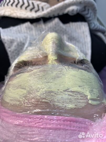 Чистки лица,пилинги,мезо и биоревитализация