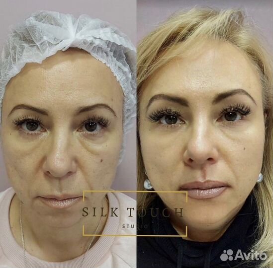 Обучение холодная плазма