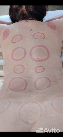 Массаж. лазерная эпиляция