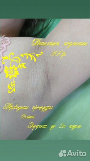Депиляция